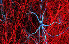 光聲成像應用-OPO激光器